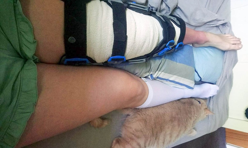 My leg is all wrapped up for Christmas, my fluffy friend is taking care of me.